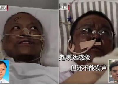 پوست بدن دو پزشک چینی با کرونا سیاه شد